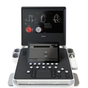 Ultrassom Portátil Philips Compacto 5300 - Imagem 7